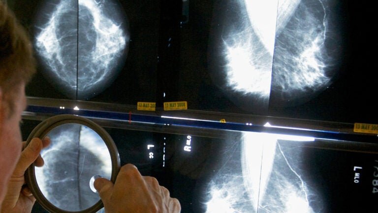 Mass. high school to undergo testing after several female teachers diagnosed with breast cancer