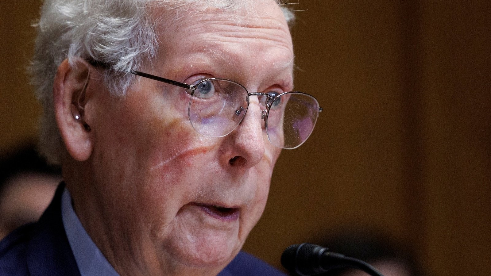 Thune says McConnell is ‘dialed in’ after Sunday hospitalization