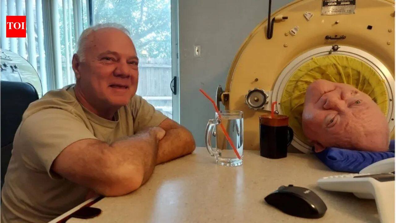 A six-year-old entered an iron lung after polio. More than 70 years later, he had become the world’s longest-known survivor | World News