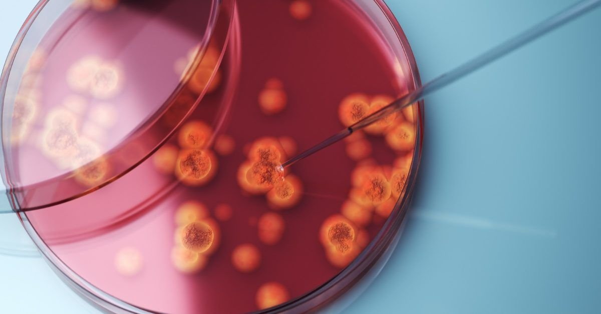 Drug-Resistant ‘Superbug’ Confirmed in 23 States: Should You Worry?